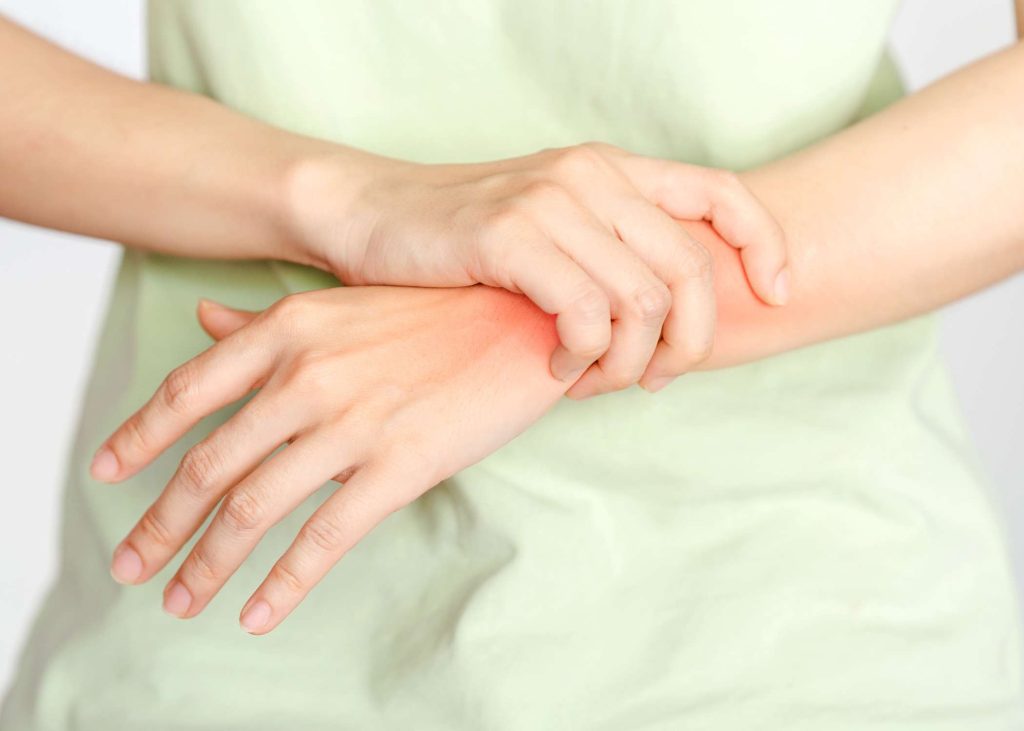 Physical Therapy for Rheumatoid Arthritis