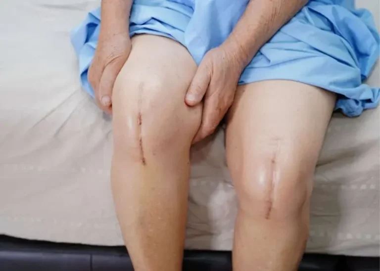 Physical Therapy in Philadelphia and Bucks County